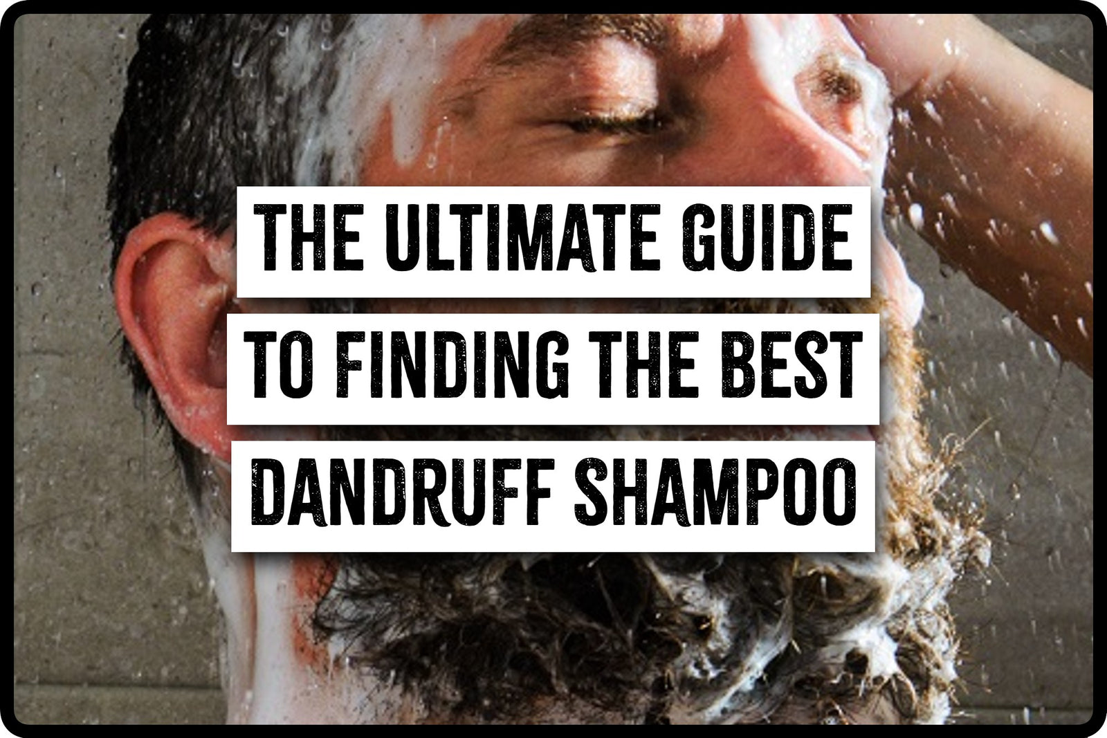The Ultimate Guide to Finding the Best Dandruff Shampoo