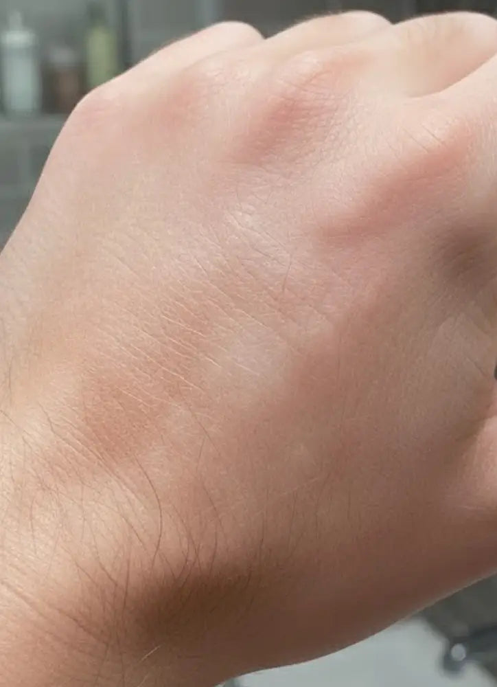 Close-up of a person's wrist with visible skin texture.