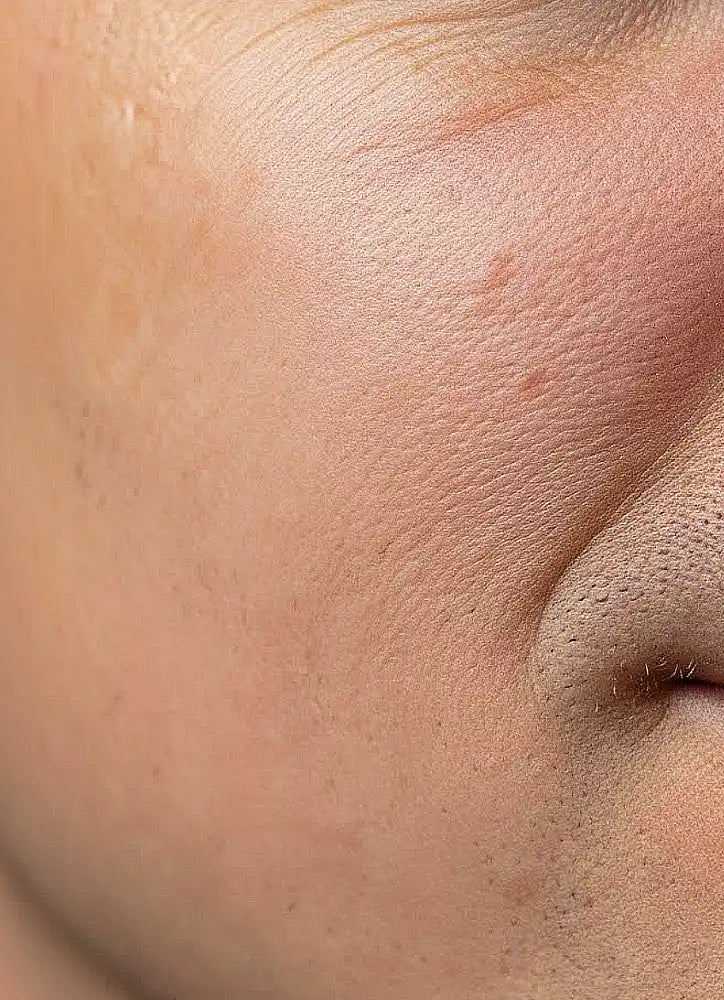 Close-up of a person's skin with visible pores and texture