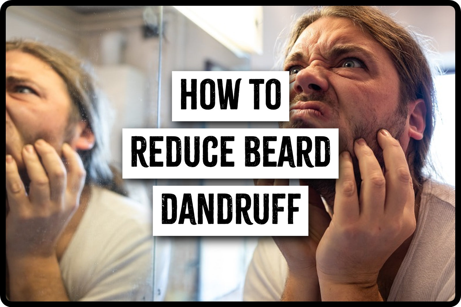 How to reduce Beard Dandruff, step by step guide