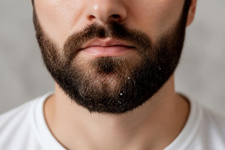Reduce Beard Dandruff: Science-Backed Solutions for 2026