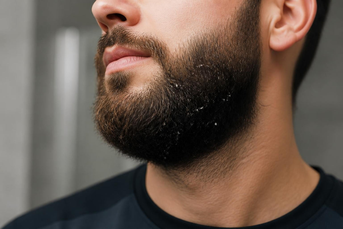 Flakes Under Beard: Science-Backed Solutions for 2026