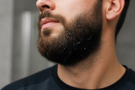 Flakes Under Beard: Science-Backed Solutions for 2026