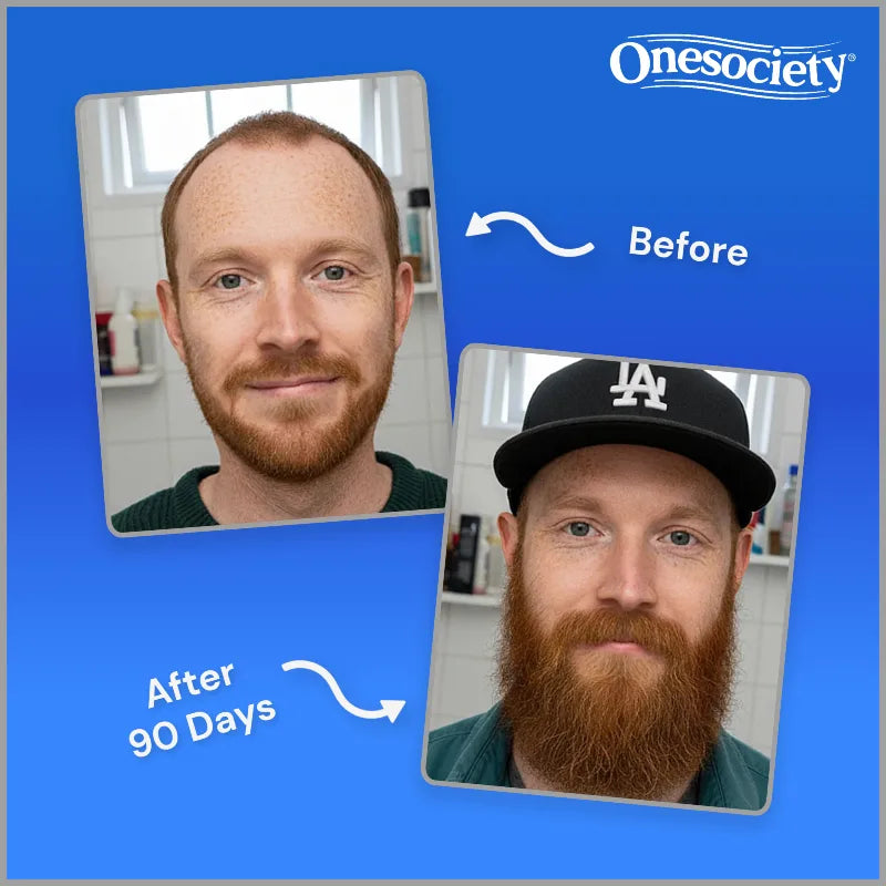 Before and after comparison of a man with a beard, showing growth over 90 days, with Onesociety branding.