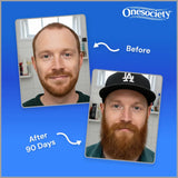 Before and after comparison of a man with a beard, showing growth over 90 days, with Onesociety branding.