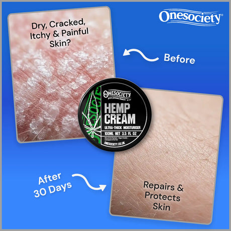 Before and after comparison of dry, cracked skin with Hemp Cream, featuring Onesociety brand.