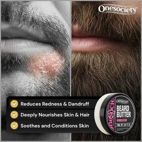 Close-up of a beard with redness and dandruff, showing the benefits of Onesociety Beard Butter.